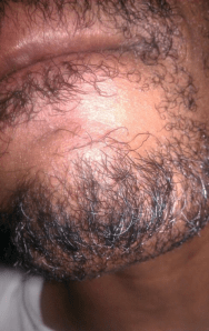 pic of the week 3-6-2013